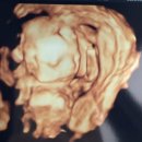 익산제일병원 | 임신 23주 4일차 | 익산 제일산부인과 정밀초음파 후기