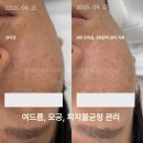 엠메디 네이버블로그