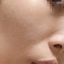 나의피부에게
