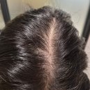 올댓노래연습장 | [탈색모, 정수리탈모 두피관리샵 추천] 올댓스칼프 부산경성대본점 리질리언스케어 후기