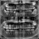 삐뚤한이바르게치과교정과치과의원 이미지