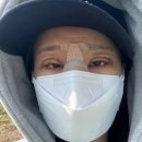 연당원장애인화장실 | 10년만에 눈,코 재수술 후기 2편