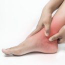 발과 발목 통증, 부위에 따라 질환이 다르다? 이미지
