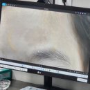 부산반점 - 창녕군 명덕로 5 | 부산 밀크커피반점 레이저 치료 후기｜더퍼스트피부과 20회 치료 솔직 후기