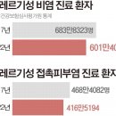 건조하면 간질간질…목욕 뒤 3분내, 하루 3회 보습제 발라야 이미지