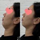 케틀벨뷰티 네이버블로그