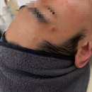 월드컵약국 | 마포구청 월드컵경기장 디지털미디어시티 좁쌀여드름 흉터 모공