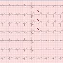 웰에이징김정혁내과의원 이미지