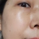 멜라 뷰티 | 슬립스마트 식물성 멜라토닌 함유 멜라뷰티 섭취 후기