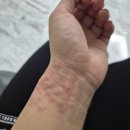 김혜영피부과
