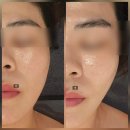 상동역1번출구 | 부천에스테틱 에이엘뷰티 후기｜상동역 1분 얼굴윤곽관리