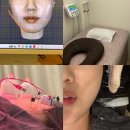 청담 모드니한의원 안면비대칭 교정 1회차 솔직후기 비용 예약방법