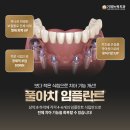 뉴욕플란트치과의원 이미지
