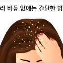 머리 비듬 없애는 간단한 방법 이미지