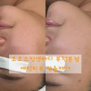 코코피부 | [내돈내산] 부천 신중동역 &#39;코코스킨앤바디&#39; 찐 후기 / 예민피부 맞춤 케어