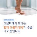 하지웰심장혈관흉부외과의원 | 동래 하지정맥 수술, 결정은 ‘혈액의 흐름’을 보고 합니다