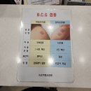 참외과 참소아청소년과의원 | 신생아 BCG 피내용 접종 1차 영유아검진 광주 더블유소아청소년과의원