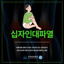 사우동정형외과 운동 후 불안정한 무릎, 십자인대파열 이미지