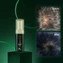 정도약품 | 잃어버린 자신감, 현대약품 마이녹셀 스칼프 인텐시브 탈모앰플로 되찾은 감동적인 후기!