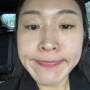 (주)나람 | 내돈내산 쥬베룩 리쥬란