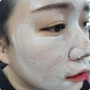 인셀덤부평대리점 | 부평피부관리 인셀덤 부평대리점 좁쌀여드름 때문에 방문했어요