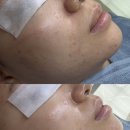 송내코아 | [부천/송내] 에버딘에스테틱 _ 문제성 피부 맞춤 관리/부천 에스테틱 추천