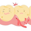 잇몸 부었을때 약보다 치과가야 하는 이유3가지