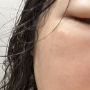 싱그런한내과의원 | 025 인도 병원 입원 후기(구르가온 포티스 응급실/입원)