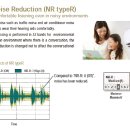더원보청기 이미지