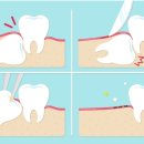 퍼스트사랑니치과의원 이미지
