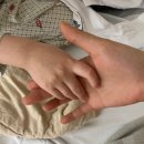 남일전력 | 혈종? 그냥 도망쳐라..? 과연? 소아혈액종양과 간호사의 ㄹㅈㄷ 솔직한 근무 후기.