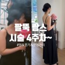 때빼멍 | 대전 팔뚝 무한람스 한달차 후기 : 붓기 빠진 뒤 멍·뭉침과 팔라인 변화