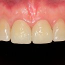 이-라인치과기공소 이미지