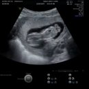 한체대 공감 PT 이미지