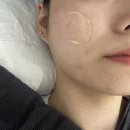 지음에스테틱 | 전주피부관리 추천 효자동 지음에스테틱 솔직후기