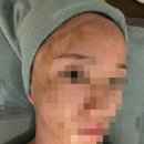 민에스테틱화장품 | 대구남구에스테틱 민레스트Minrest 얼굴라인관리 후기