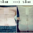 엔비코르셋