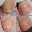 good nail(굿네일)