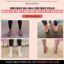화정동 1012-2 | 화정PT, 여성전용 피트니스벨] 발 아치/백니/골반교정 성공! 체형이 눈에 뛰게 변화되었어요.