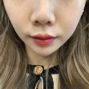 제나하이얀 | 일상) 레이저토닝 효과 그리고 2차후기자세히알려드려요