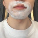 메티의원 | [논현/강구] 남자친구 턱인중 레이저제모 1회차