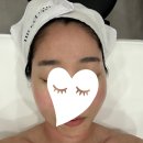 하이필스킨 | 선릉피부관리 압출 및 여드름 관리 :: 하이필스킨 후기