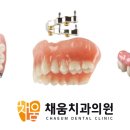 채움치과기공소 이미지