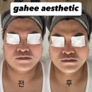 가희에스테틱