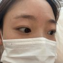 천안성정중학교 | [천안두정동] 미모델링 | 두정LED속눈썹연장 맛집 미모델링 Before/After 후기❤️