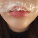 온도성형외과 인중축소 윗입술확장 반영구 시술 솔직 후기(내돈내산, 광고×)