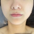 델루나뷰티 | 델루나뷰티, 김포 풍무역 1인 피부관리샵, LDM 물방울 피부관리 후기