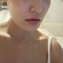 쥬베룩 볼륨 3차까지 맞은 솔직후기(전후변화+유지관리)