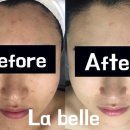 라 벨르 에스테틱 이미지