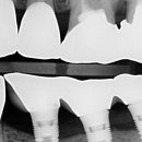 덴치과기공소 이미지